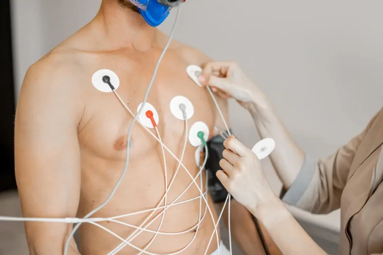 Holter 24 Horas